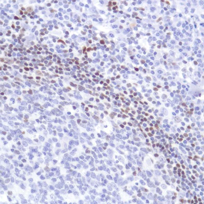 Immunohistochemistry (Formalin/PFA-fixed paraffin-embedded sections) - Anti-SATB1 antibody [SP287] - C-terminal (AB226834)
