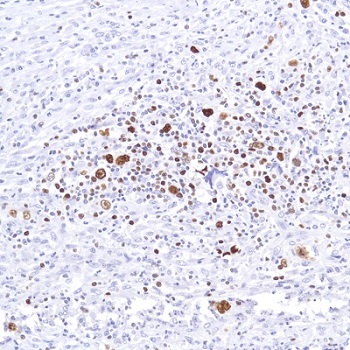 Immunohistochemistry (Formalin/PFA-fixed paraffin-embedded sections) - Anti-SATB1 antibody [SP287] - C-terminal (AB226834)