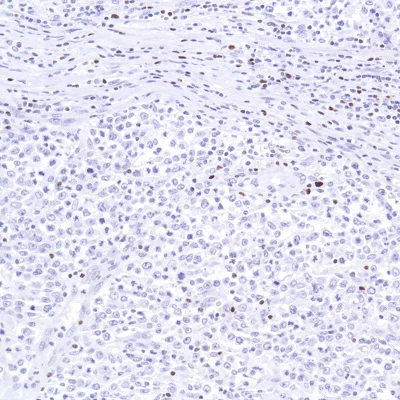 Immunohistochemistry (Formalin/PFA-fixed paraffin-embedded sections) - Anti-SATB1 antibody [SP287] - C-terminal (AB226834)