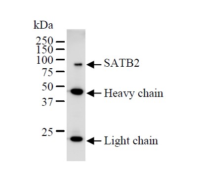 Immunoprecipitation - Anti-SATB1 + SATB2 antibody [SATBA4B10] - C-terminal (AB51502), expandable thumbnail