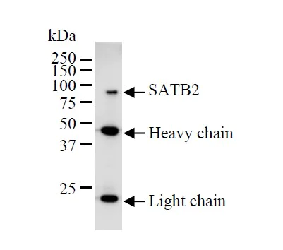 Immunoprecipitation - Anti-SATB1 + SATB2 antibody [SATBA4B10] - C-terminal (AB51502)