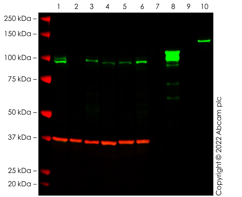 Western blot - Anti-SATB1 + SATB2 antibody [SATBA4B10] - C-terminal (ab51502), expandable thumbnail