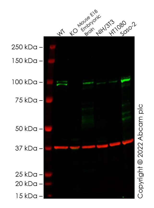 Western blot - Anti-SATB1 + SATB2 antibody [SATBA4B10] - C-terminal (AB51502)