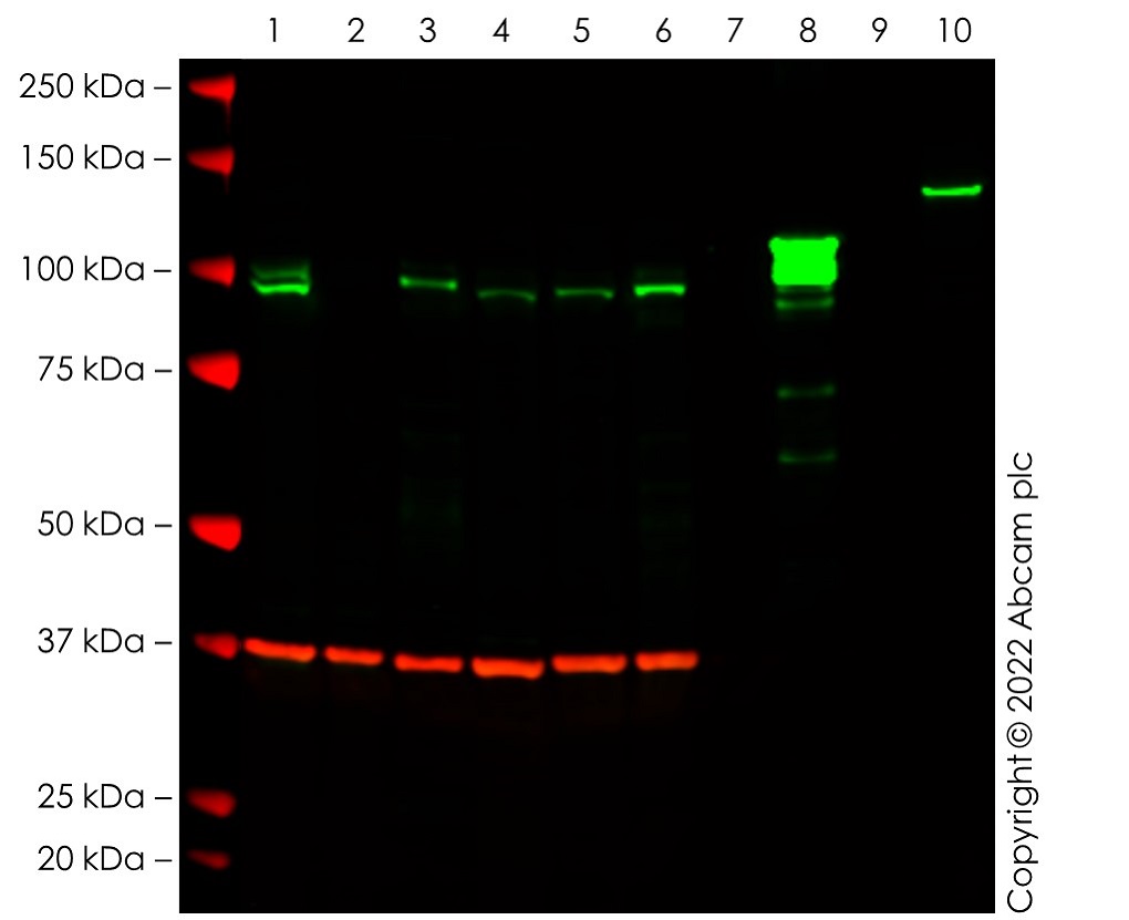 Western blot - Anti-SATB1 + SATB2 antibody [SATBA4B10] - C-terminal (AB51502), expandable thumbnail