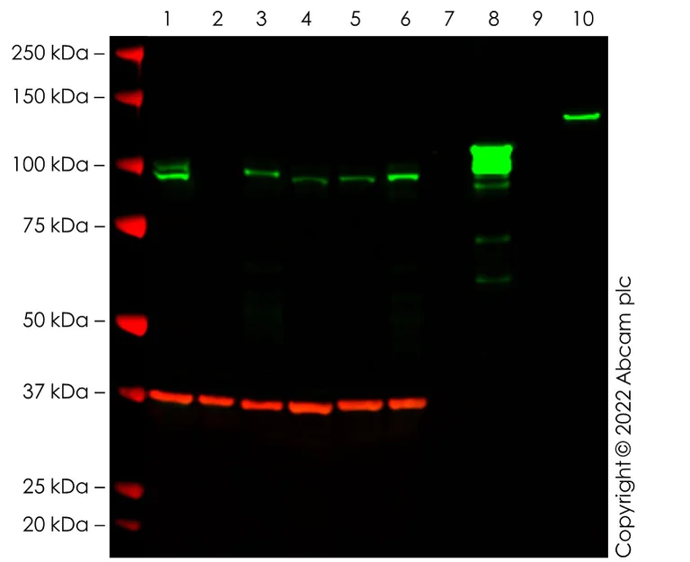 Western blot - Anti-SATB1 + SATB2 antibody [SATBA4B10] - C-terminal (AB51502)