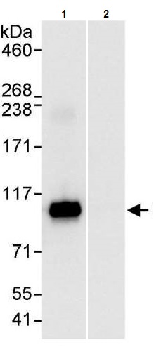 Immunoprecipitation - Anti-SATB2 antibody (AB245424)