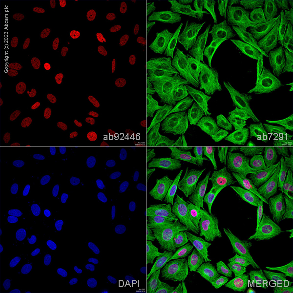 Immunocytochemistry/ Immunofluorescence - Anti-SATB2 antibody [EPNCIR130A] (ab92446), expandable thumbnail