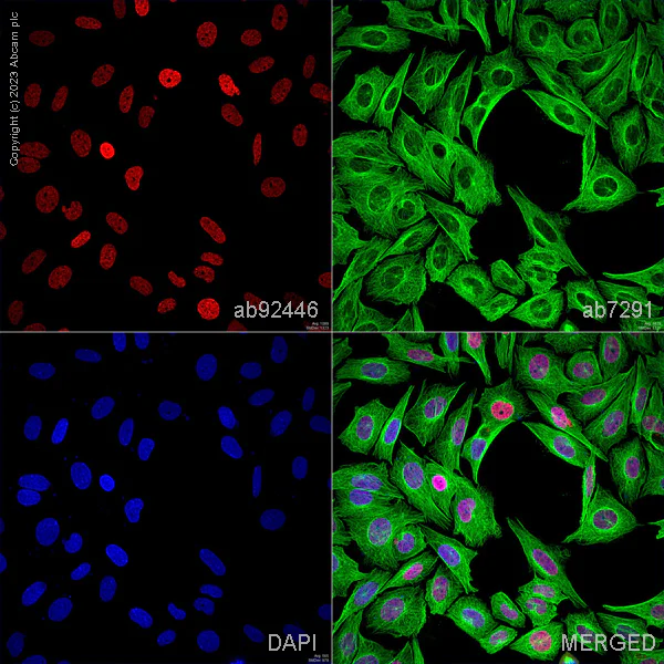 Immunocytochemistry/ Immunofluorescence - Anti-SATB2 antibody [EPNCIR130A] (AB92446)