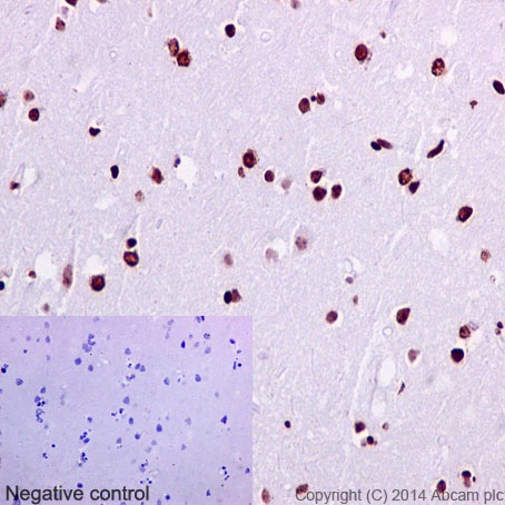 Immunohistochemistry (Formalin/PFA-fixed paraffin-embedded sections) - Anti-SATB2 antibody [EPNCIR130A] (AB92446), expandable thumbnail