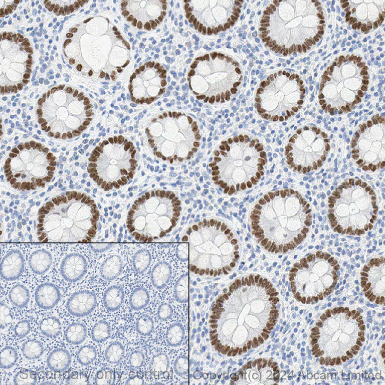 Immunohistochemistry - Anti-SATB2 antibody [EPNCIR130A] (AB92446)