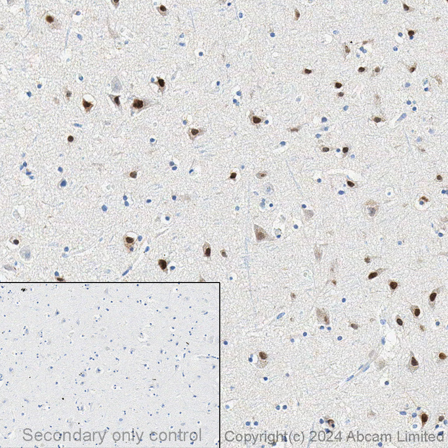 Immunohistochemistry - Anti-SATB2 antibody [EPNCIR130A] (ab92446), expandable thumbnail