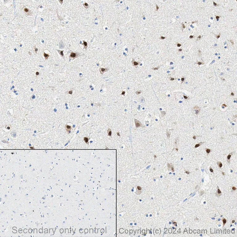 Immunohistochemistry - Anti-SATB2 antibody [EPNCIR130A] (AB92446)