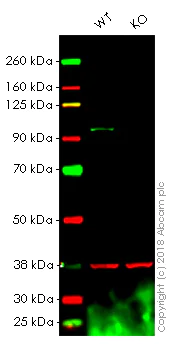 Western blot - Anti-SATB2 antibody [EPNCIR130A] (AB92446)