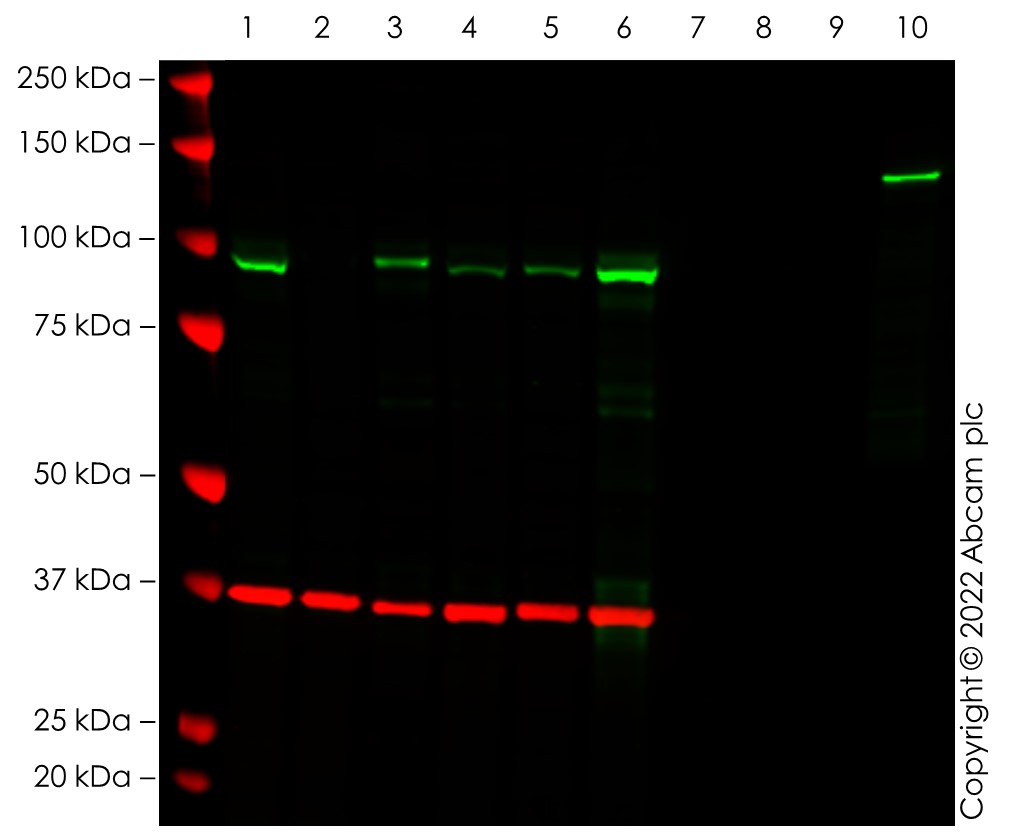 Western blot - Anti-SATB2 antibody [EPNCIR130A] (ab92446), expandable thumbnail