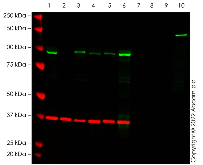 Western blot - Anti-SATB2 antibody [EPNCIR130A] (AB92446)