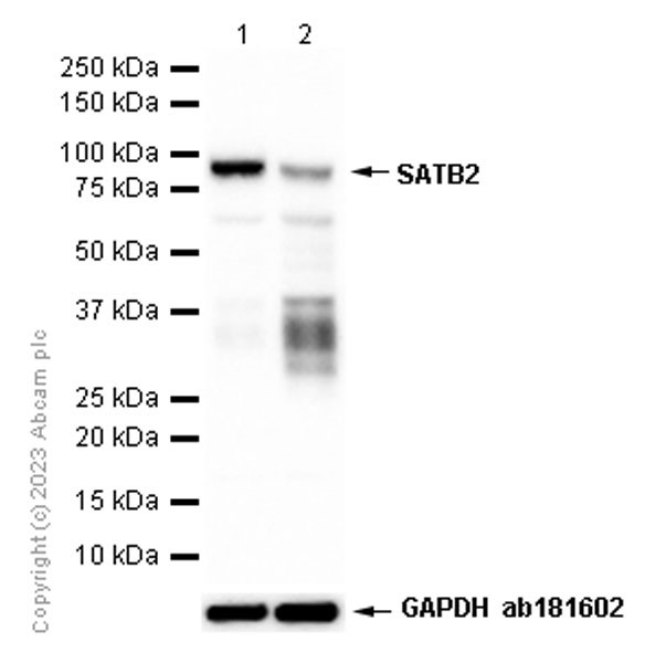 Western blot - Anti-SATB2 antibody [EPNCIR130A] (ab92446), expandable thumbnail
