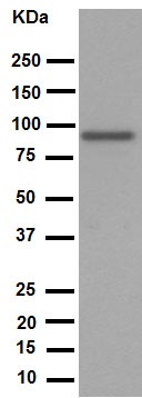 Western blot - Anti-SATB2 antibody [EPNCIR130A] (AB92446), expandable thumbnail