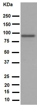 Western blot - Anti-SATB2 antibody [EPNCIR130A] (AB92446)