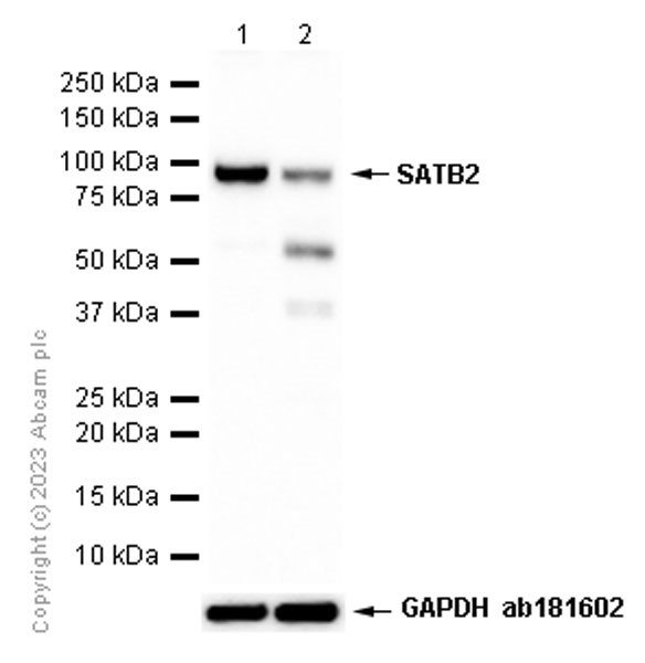 Western blot - Anti-SATB2 antibody [EPNCIR130B] (AB133328)