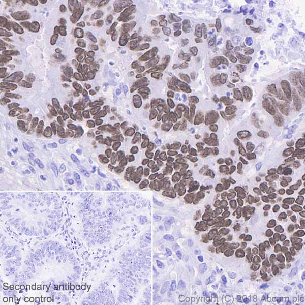 Immunohistochemistry (Formalin/PFA-fixed paraffin-embedded sections) - Anti-SATB2 antibody [EPNCIR130B] - BSA and Azide free (AB212176)