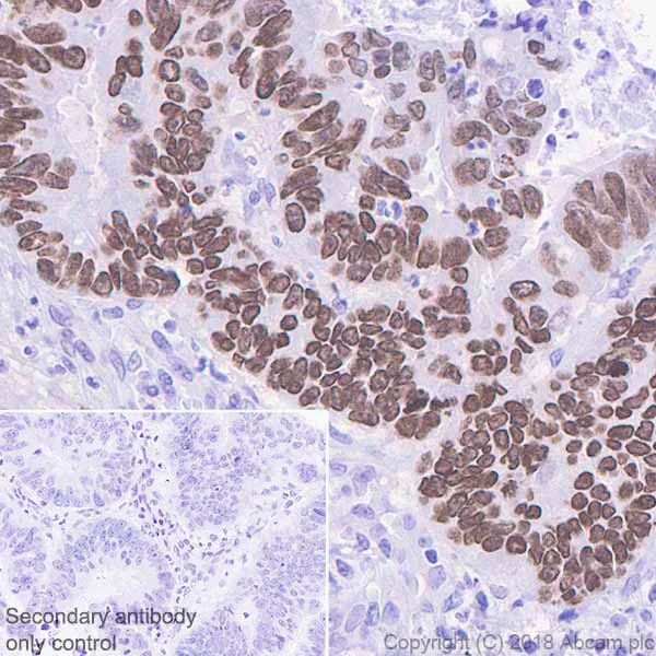 Immunohistochemistry (Formalin/PFA-fixed paraffin-embedded sections) - Anti-SATB2 antibody [EPNCIR130B] - BSA and Azide free (AB212176)