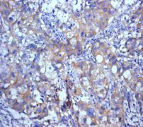 Immunohistochemistry (Formalin/PFA-fixed paraffin-embedded sections) - Anti-SATB2 antibody [EPNCIR130B] - BSA and Azide free (AB212176)