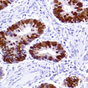 Immunohistochemistry (Formalin/PFA-fixed paraffin-embedded sections) - Anti-SATB2 antibody [SP281] - BSA and Azide free (AB238787)