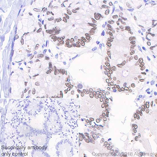 Immunohistochemistry (Formalin/PFA-fixed paraffin-embedded sections) - Anti-SATB2 antibody [SP281] - BSA and Azide free (AB238787)