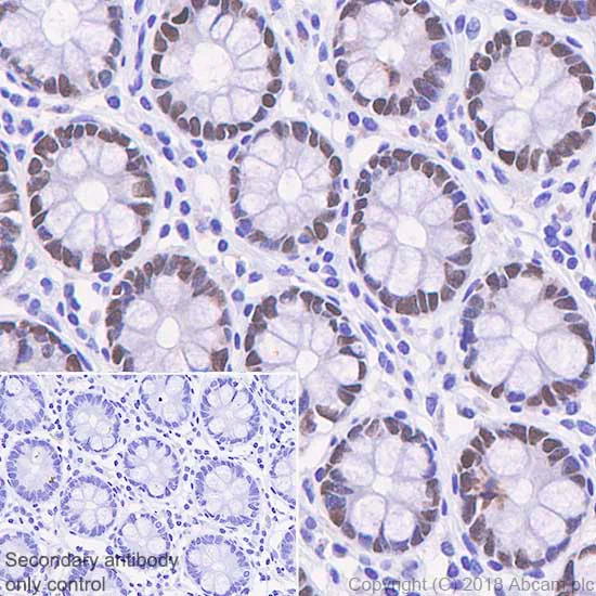 Immunohistochemistry (Formalin/PFA-fixed paraffin-embedded sections) - Anti-SATB2 antibody [SP281] - BSA and Azide free (AB238787)