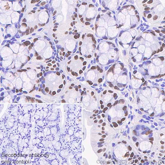Immunohistochemistry (Formalin/PFA-fixed paraffin-embedded sections) - Anti-SATB2 antibody [SP281] - BSA and Azide free (AB238787)