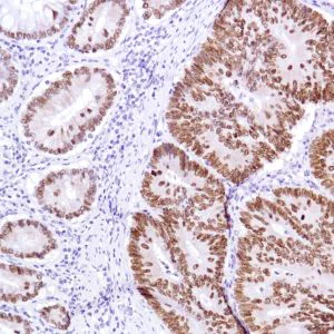 Immunohistochemistry (Formalin/PFA-fixed paraffin-embedded sections) - Anti-SATB2 antibody [SP281] - BSA and Azide free (AB238787)