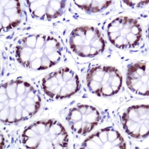 Immunohistochemistry (Formalin/PFA-fixed paraffin-embedded sections) - Anti-SATB2 antibody [SP281] - BSA and Azide free (AB238787)