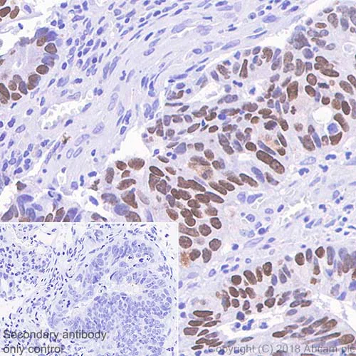Immunohistochemistry (Formalin/PFA-fixed paraffin-embedded sections) - Anti-SATB2 antibody [SP281] - BSA and Azide free (AB238787)