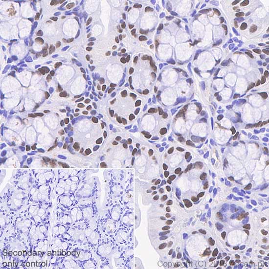 Immunohistochemistry (Formalin/PFA-fixed paraffin-embedded sections) - Anti-SATB2 antibody [SP281] - C-terminal (AB227686), expandable thumbnail