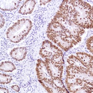 Immunohistochemistry (Formalin/PFA-fixed paraffin-embedded sections) - Anti-SATB2 antibody [SP281] - C-terminal (ab227686), expandable thumbnail