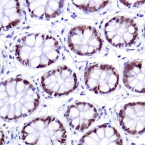 Immunohistochemistry (Formalin/PFA-fixed paraffin-embedded sections) - Anti-SATB2 antibody [SP281] - C-terminal (ab227686), expandable thumbnail