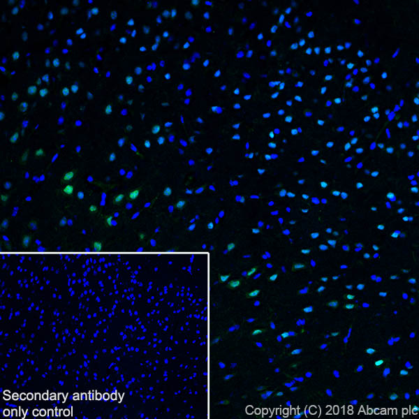 Immunohistochemistry (PFA perfusion fixed frozen sections) - Anti-SATB2 antibody [SP281] - C-terminal (AB227686), expandable thumbnail