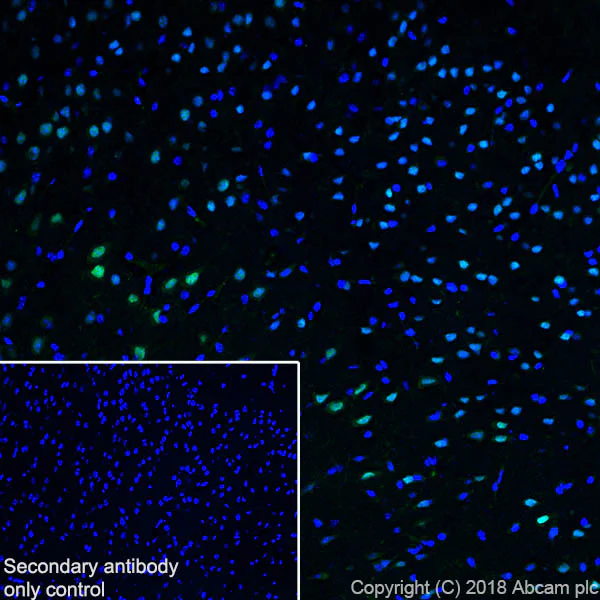 Immunohistochemistry (PFA perfusion fixed frozen sections) - Anti-SATB2 antibody [SP281] - C-terminal (AB227686)