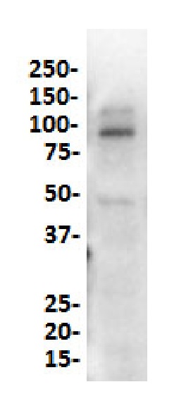 Western blot - Anti-SATB2 antibody [SP281] - C-terminal (ab227686), expandable thumbnail