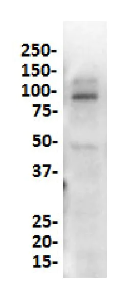 Western blot - Anti-SATB2 antibody [SP281] - C-terminal (AB227686)