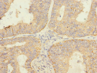 Immunohistochemistry (Formalin/PFA-fixed paraffin-embedded sections) - Anti-SAV1 antibody (AB230265), expandable thumbnail