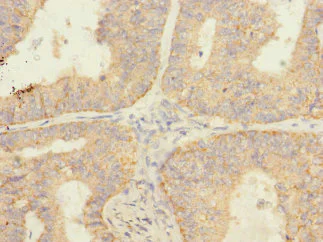 Immunohistochemistry (Formalin/PFA-fixed paraffin-embedded sections) - Anti-SAV1 antibody (AB230265)