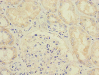 Immunohistochemistry (Formalin/PFA-fixed paraffin-embedded sections) - Anti-SAV1 antibody (AB230265), expandable thumbnail