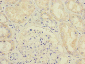 Immunohistochemistry (Formalin/PFA-fixed paraffin-embedded sections) - Anti-SAV1 antibody (AB230265)