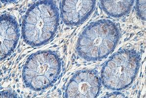 Immunohistochemistry (Formalin/PFA-fixed paraffin-embedded sections) - Anti-SBCAD antibody (AB99951)