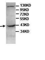 Western blot - Anti-SBCAD antibody (AB99951)