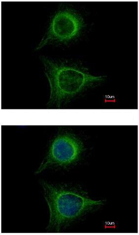 Immunocytochemistry/ Immunofluorescence - Anti-SBDS antibody (AB154222), expandable thumbnail
