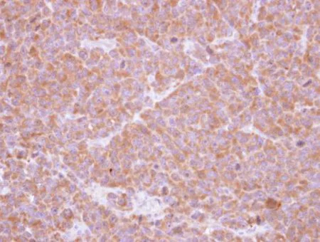 Immunohistochemistry (Formalin/PFA-fixed paraffin-embedded sections) - Anti-SBDS antibody (AB154222)