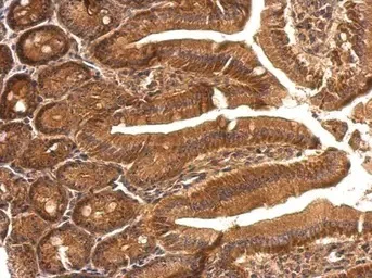 Immunohistochemistry (Formalin/PFA-fixed paraffin-embedded sections) - Anti-SBDS antibody (AB154222)