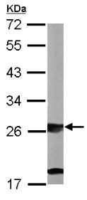 Western blot - Anti-SBDS antibody (AB154222), expandable thumbnail
